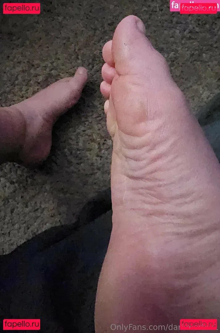 darkmorbid1 Onlyfans Photo Gallery 