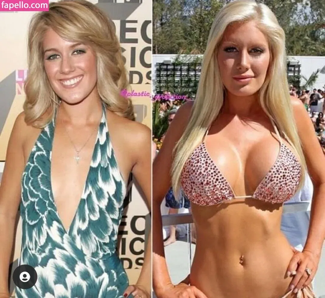 Heidi Montag Onlyfans Photo Gallery 