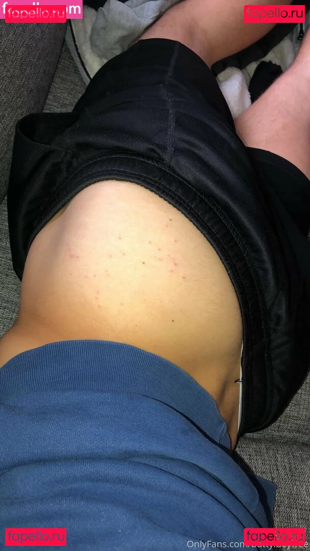 battyboyfree Onlyfans Photo Gallery 
