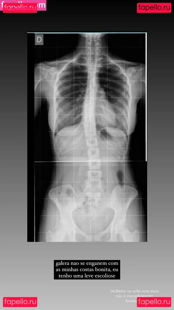 ilamie Onlyfans Photo Gallery 