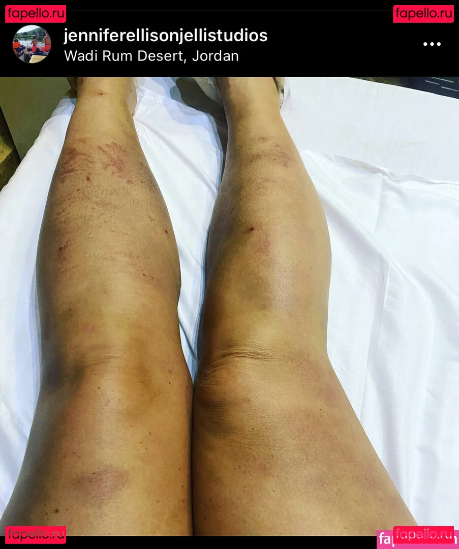 Jennifer Ellison Onlyfans Photo Gallery 