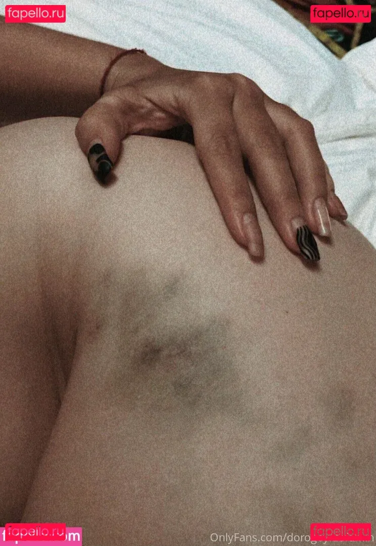 obs.cure Onlyfans Photo Gallery 