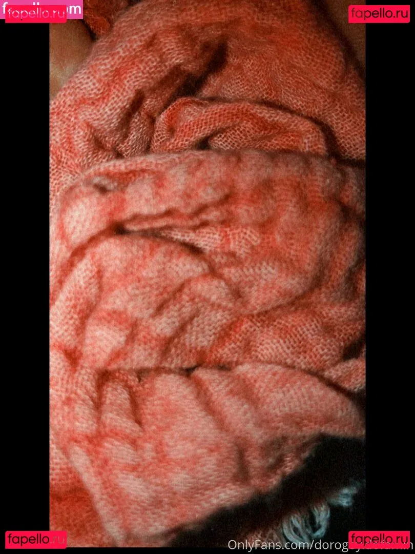 obs.cure Onlyfans Photo Gallery 