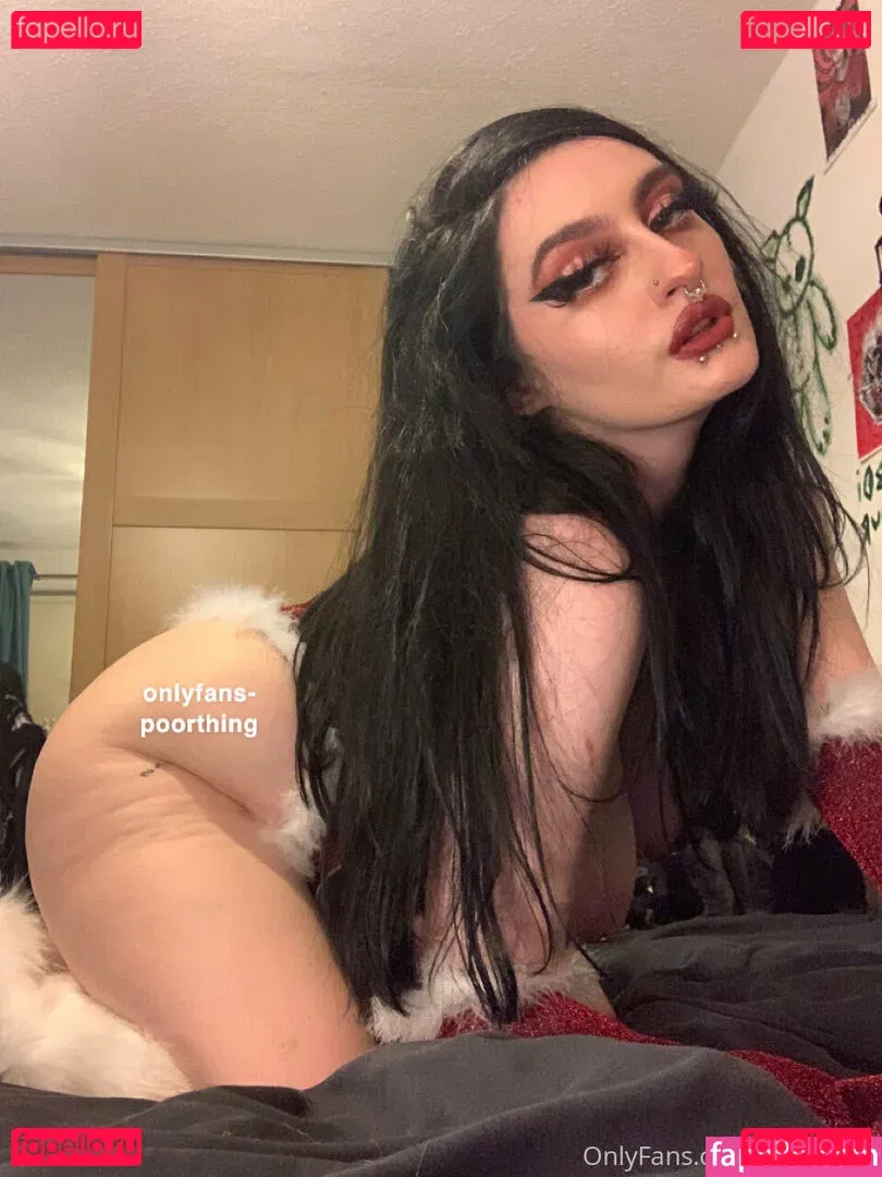 poorthing Onlyfans Photo Gallery 